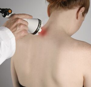 Laser therapy will help relieve inflammation and activate neck tissue regeneration