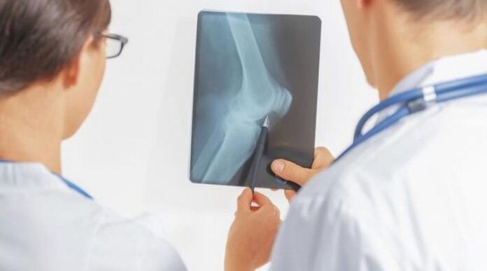 After making the necessary diagnosis of the knee joint, the doctor carries out complex treatments