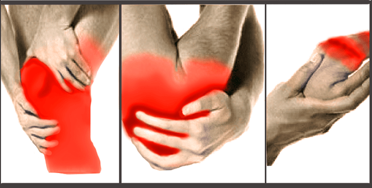 inflammation