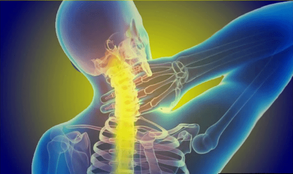 Cervical injury