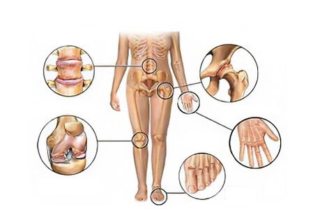 Types of joints