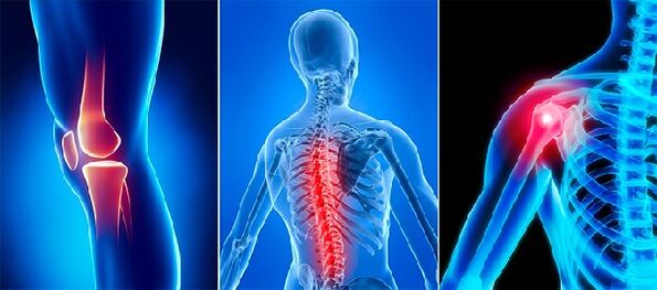 Joint pain