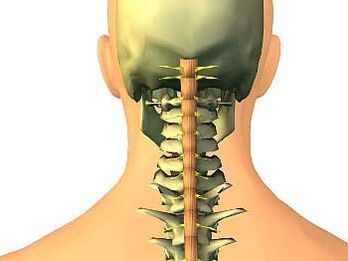 Osteochondral disease in the cervical area