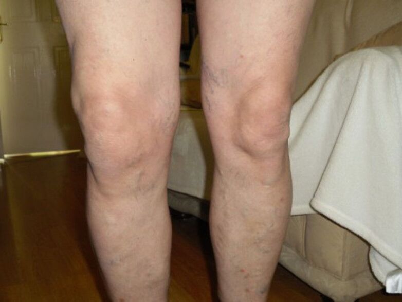 Healthy knees and knee joints