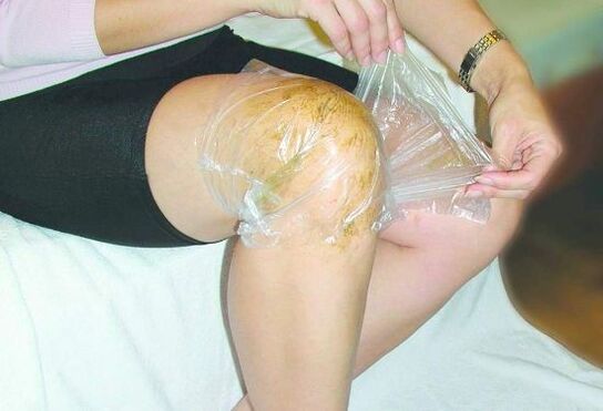 Knee compression to treat arthritis