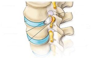 Main symptoms of cervical osteochondrosis