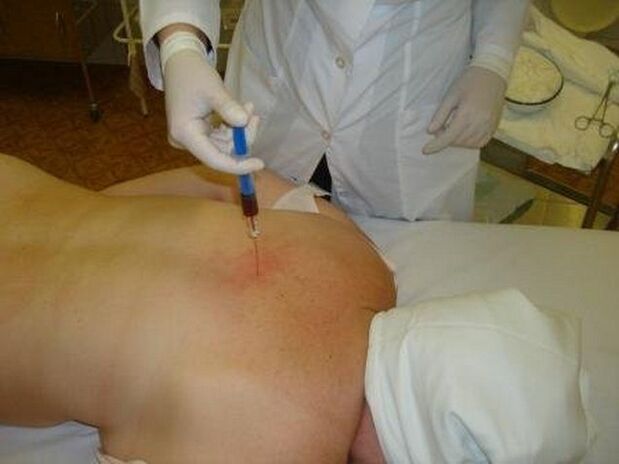 Injection therapy